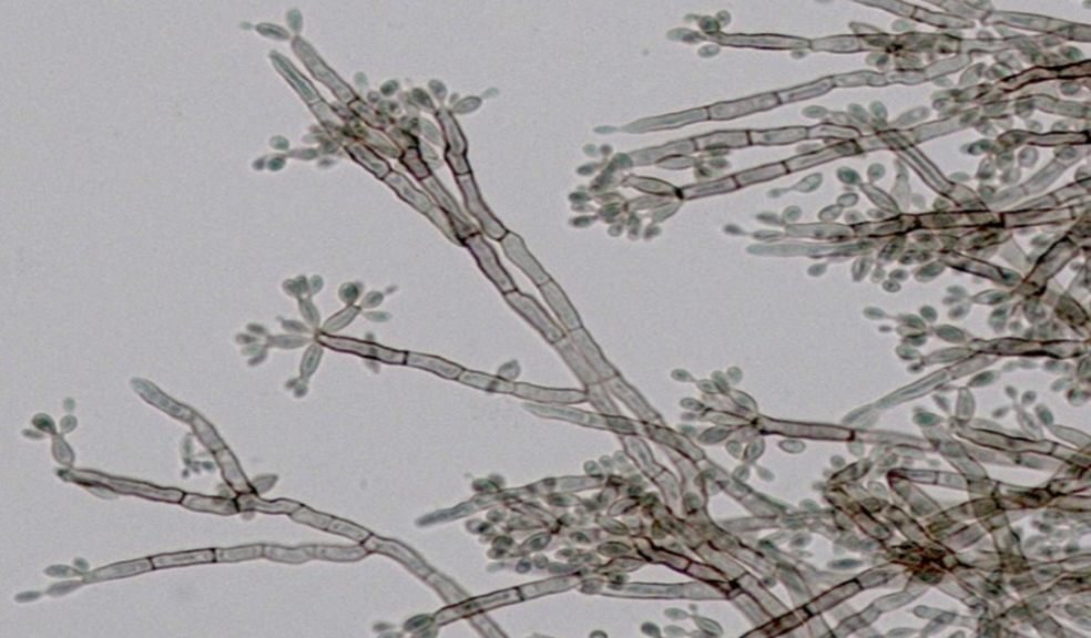 Phase contrast light micrograph of Aspergiullus fumigatus hyphae, Image: Professor Gordon Brown.