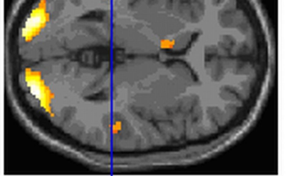 Image showing the reading network in the brain