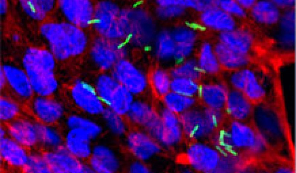 C. Difficile (green) adhering to intestinal cells
