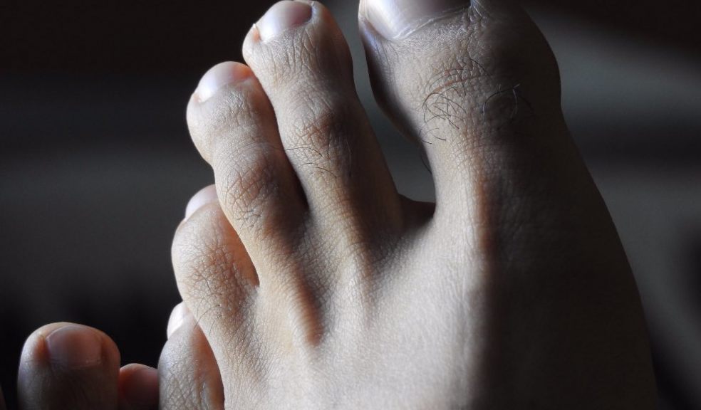 Tips for Using Tea Tree Oil for Toenail Fungus | The Exeter Daily
