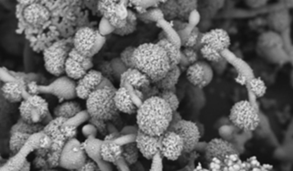 Multispecies biofilm including Candida albicans. Credit Dr Alexandra Brand (MRC CMM)